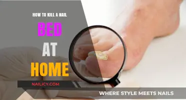 Effective Home Remedies to Eliminate Nail Bed Fungus Permanently