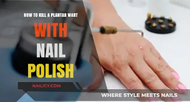 Effective Home Remedy: Using Nail Polish to Eliminate Plantar Warts