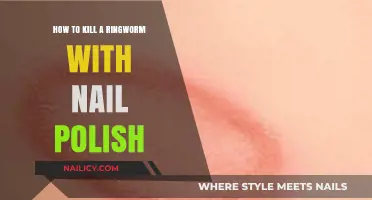 Effective Ringworm Treatment: Using Nail Polish to Kill the Fungus