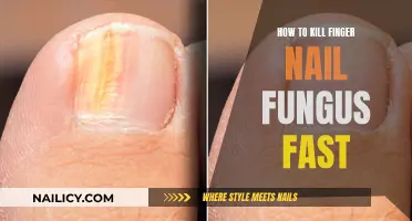 Kill Nail Fungus Fast: Effective Home Remedies