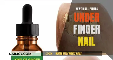 Kill Nail Fungus: Effective Home Remedies and Treatments