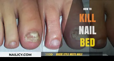 Effective Ways to Eliminate Nail Bed Fungus Permanently and Safely