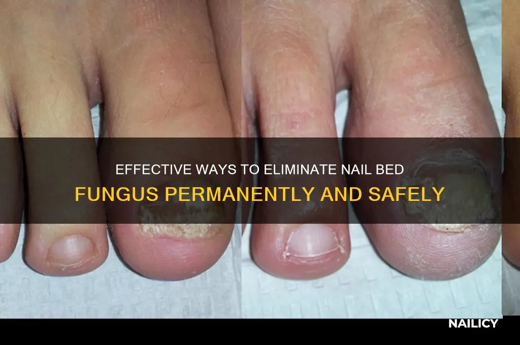 how to kill nail bed