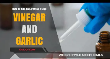 Natural Remedies: Vinegar and Garlic for Nail Fungus