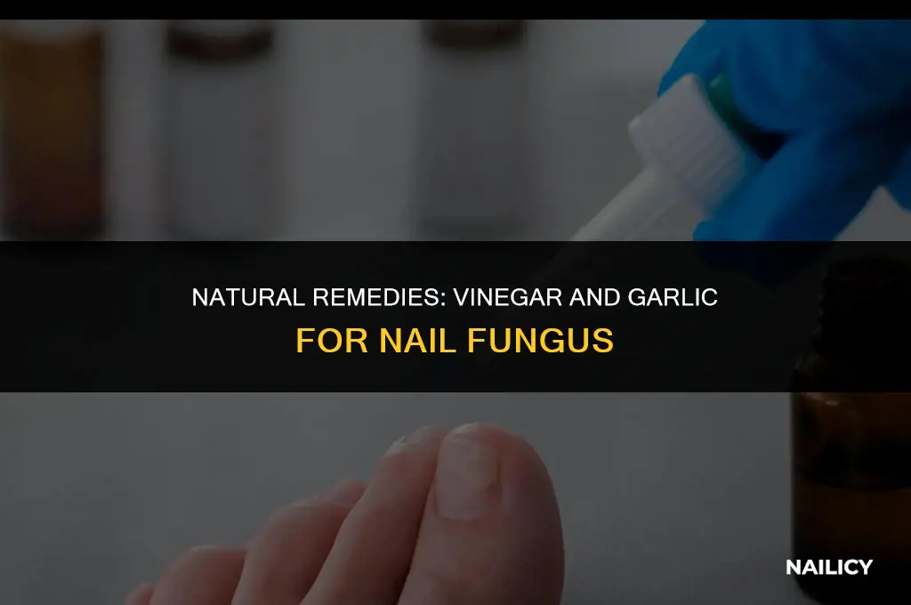 how to kill nail fungus using vinegar and garlic