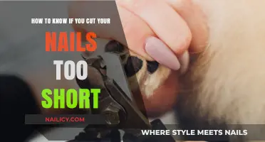 Nail Care: When Short Nails Go Wrong