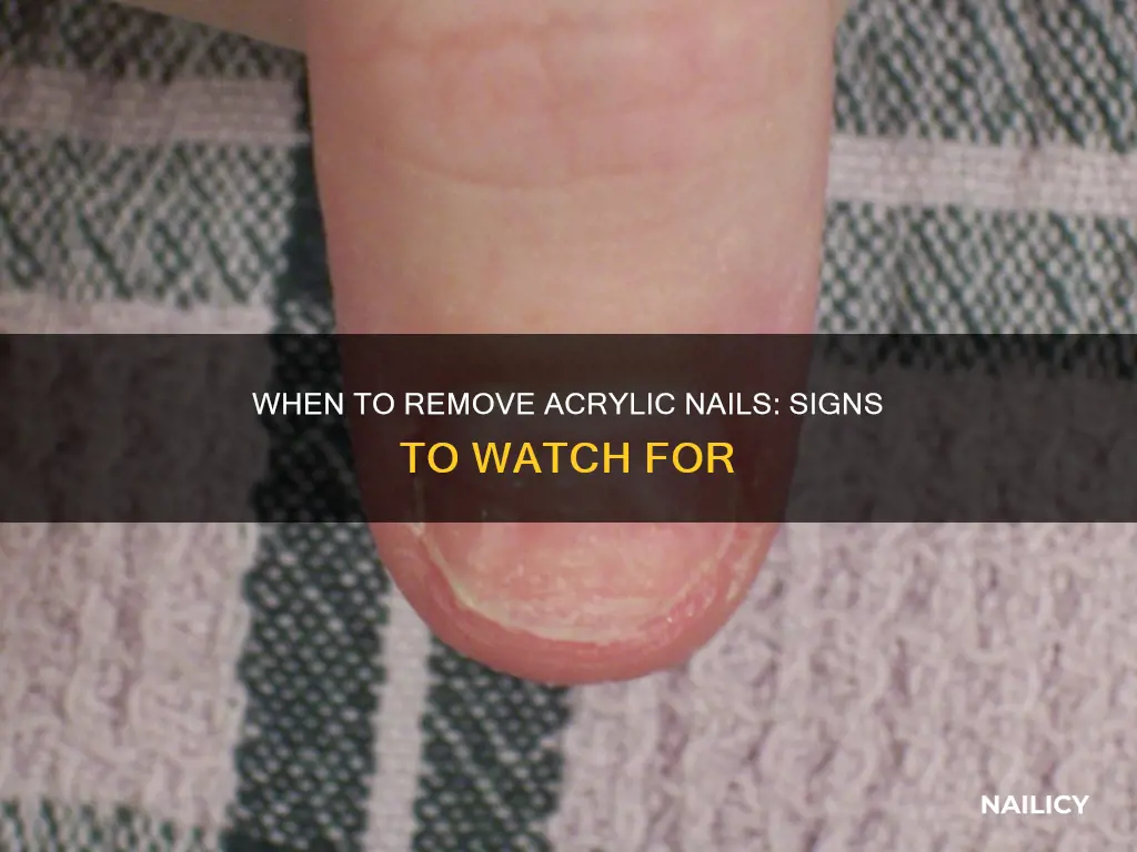 how to know when to remove acrylic nails