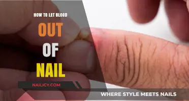 Relieving Nail Pain: Safe Steps to Drain Blood from Injured Nails