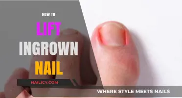 Effective Steps to Safely Lift and Treat Ingrown Nails at Home