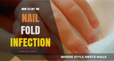 Effective Ways to Treat and Prevent Nail Fold Infections at Home