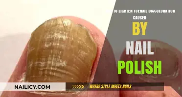 Effective Tips to Lighten Toenail Discoloration from Nail Polish