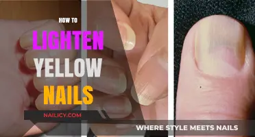 Brighten Your Smile: Effective Tips to Lighten Yellow Nails Fast