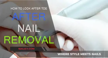 Toe Care: Post-Nail Removal Recovery Guide