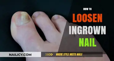Effective Home Remedies to Safely Loosen an Ingrown Toenail