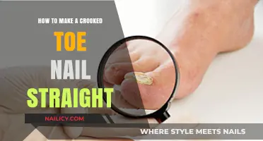 Fixing Crooked Toenails: DIY Straightening at Home