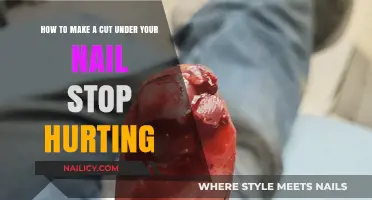 Fixing Pain from a Cut Under Your Nail