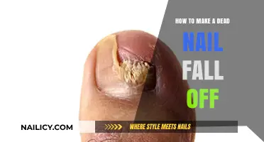 Get Rid of Dead Nails: Make Them Fall Off