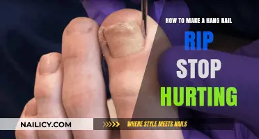 Relieving a Ripped Hang Nail: Quick Home Remedies
