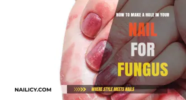 Treating Nail Fungus: Drilling Holes for Healthy Nails