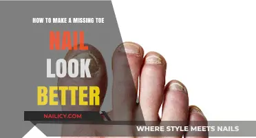 Hide Your Missing Toenail: Creative Cover-up Techniques