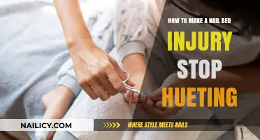 Heal Your Nail Bed Injury: Quick and Easy Relief