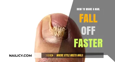 Get Rid of Damaged Nails Faster