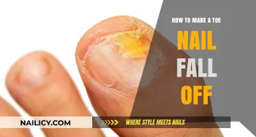 Toe Nail Trauma: Inducing Detachment