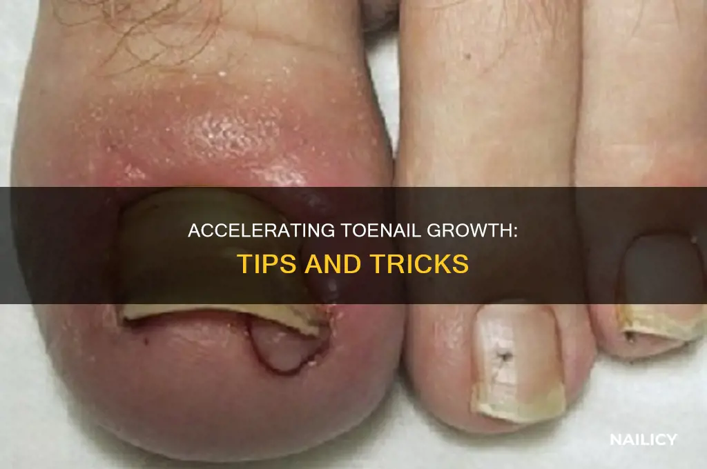 how to make a toe nail grow faster