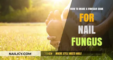 Natural Nail Fungus Treatment: Vinegar Soak Solution