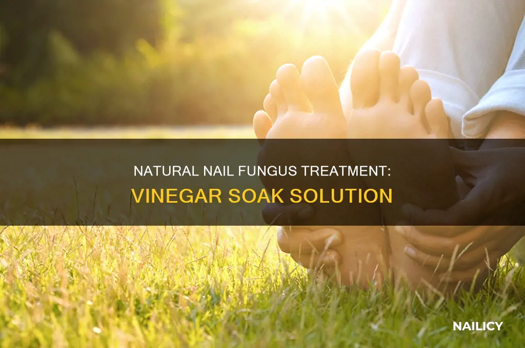 how to make a vinegar soak for nail fungus