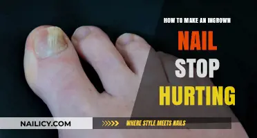 Relieving Ingrown Nail Pain: Quick and Easy Home Remedies