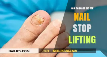Fixing a Lifting Big Toenail: Home Remedies and Prevention