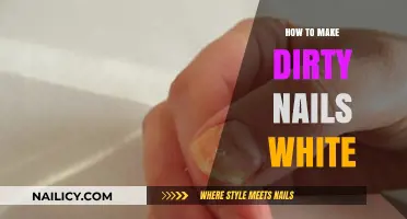 Get Rid of Yellow Nails: DIY Home Remedies