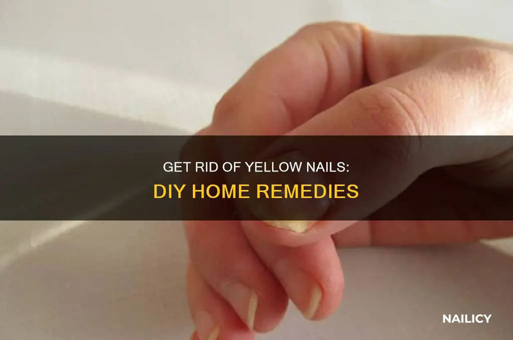 how to make dirty nails white