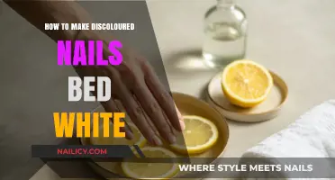 Get Rid of Discolored Nails: Natural Home Remedies