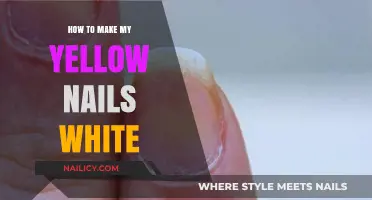 Transform Yellow Nails to White: Easy Home Remedies & Care Tips
