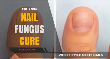 Effective Home Remedies to Treat and Eliminate Nail Fungus Fast