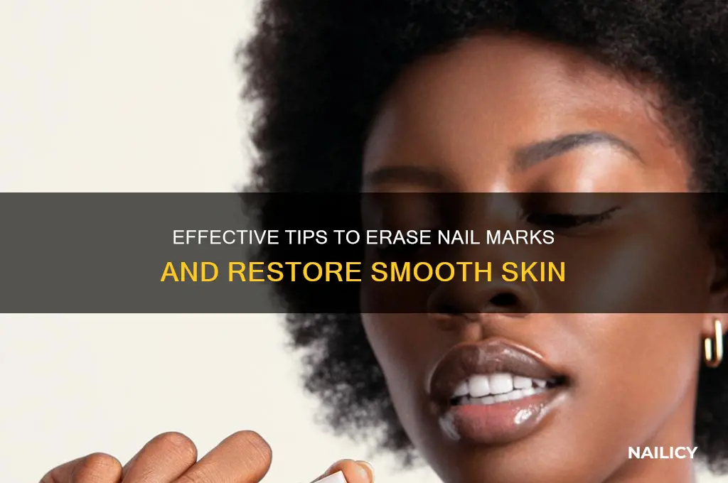 how to make nail marks go away