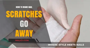Effective Remedies to Heal and Remove Nail Scratches Fast