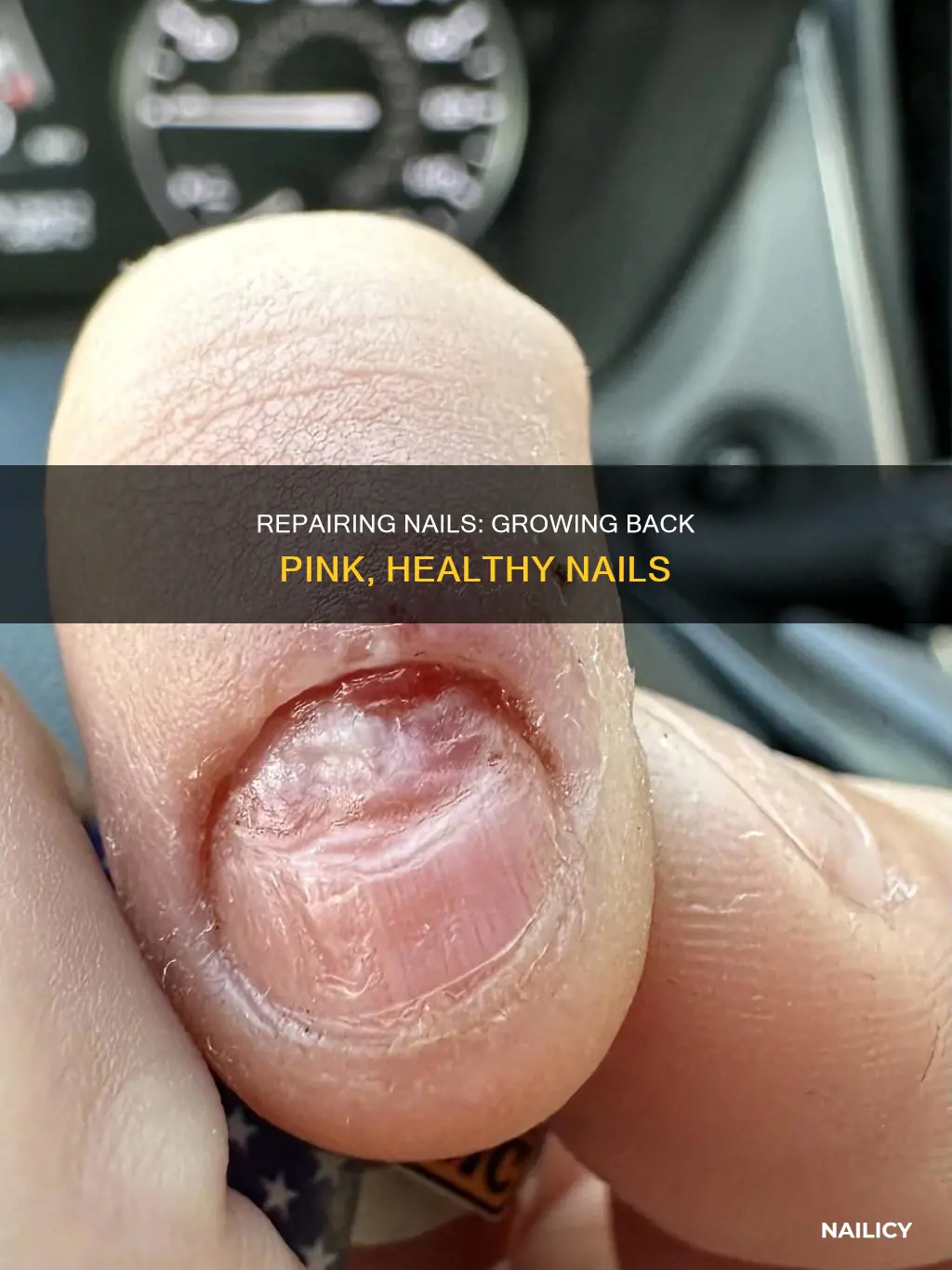 how to make pink part of nail grow back