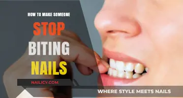 Effective Strategies to Help You Break the Nail-Biting Habit