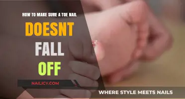 Prevent Toenail Loss: Essential Tips to Keep Your Nail Intact