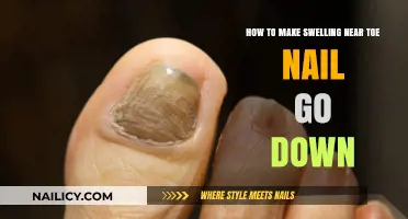 Reduce Toe Nail Swelling Fast: Simple Remedies for Quick Relief