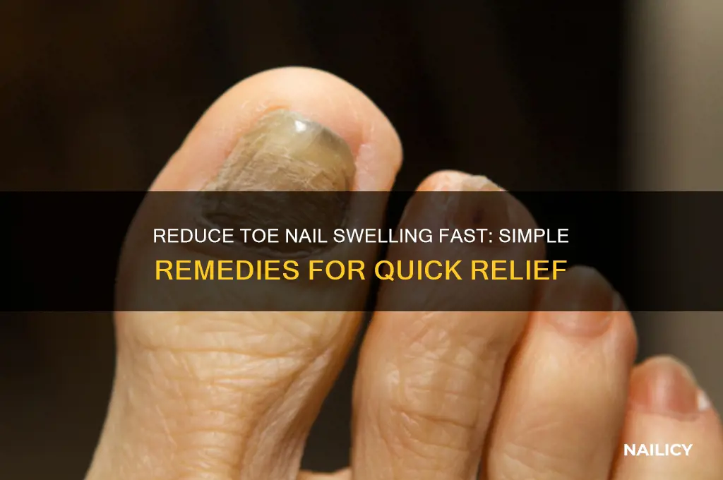 how to make swelling near toe nail go down