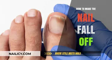 Effective Methods to Safely Remove a Damaged Toenail at Home