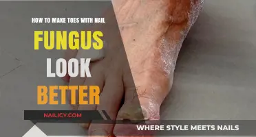 Enhance Toenail Appearance: Tips to Conceal Nail Fungus Effectively