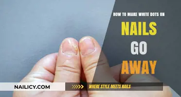 Eliminate White Dots on Nails: Simple Tips for Smooth, Healthy Nails