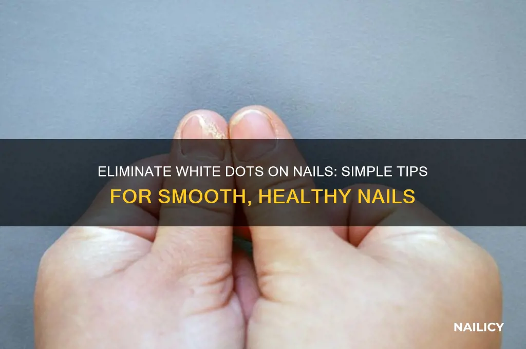 how to make white dots on nails go away