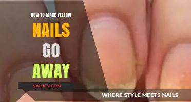 Effective Tips to Restore Natural Nail Color and Eliminate Yellowing