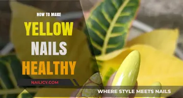 Revive Yellow Nails: Simple Steps for Healthy, Radiant Hands